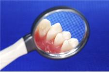 Dental Impressions image 8