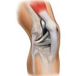 OrthoTexas - Knee Pain Frisco image 1
