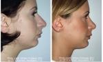 The Portland Center for Facial Plastic Surgery image 10