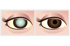 Vision and Eye Medical image 2