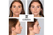 Correa Plastic Surgery image 7