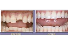 Desai Dental image 6