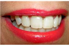 Ray Coleman Family & Cosmetic Dentistry image 1
