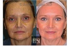 Facial Plastic Surgery Institute image 9