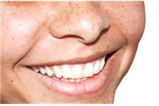 Cosmetic Dental Associates image 5
