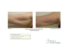 Alaska Dermatology, Laser and Skin Cancer Center image 6