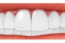 Cosmetic Dentist Brooklyn image 3