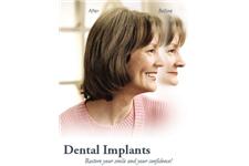 The Oral Maxillofacial & Implant Surgery Center: Scott Bulloch DDS image 2