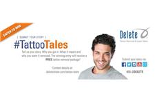 Delete Tattoo Removal & Laser Salon image 1