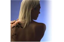 Delete Tattoo Removal & Laser Salon image 4