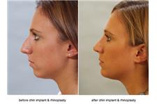 Robinson Facial Plastic Surgery image 4