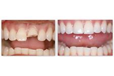 Rofe Dental Associates image 2