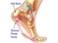 Advanced Foot and Ankle image 4