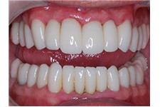 OC Dental Implants image 7