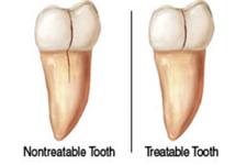 Best Endodontics of Glenview, Ltd. image 4