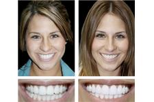 Cosmetic Dental Associates image 8