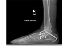 Florida Orthopedic Foot & Ankle Center image 2