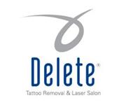 Delete Tattoo Removal & Laser Salon image 7