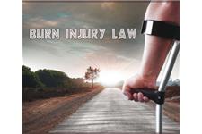 Burn Injury Law image 1