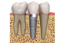 Cornerstone Family Dentistry image 6