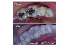 Willis & Associates Family Dentistry image 3