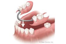 Hillrise Dental image 1