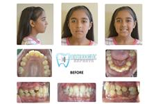 Orthodontic Experts  image 3