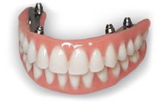 Dental Ceramic Crowns image 1
