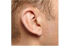 AA Hearing Aid Center image 10