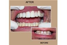 Antoon Family Dental image 8