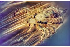 The Louse Girl Head Lice Removal Service image 1