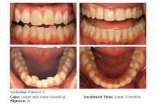 Westlake Smile Design Invisalign Dentists image 1