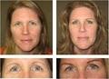 Beautiologist Permanent Makeup and Cosme image 3