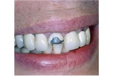 Richard Wilson D.D.S. Emergency Dentist image 5