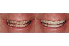 Bauer Dentistry and Orthodontics image 6