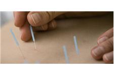 Acupuncture and Integrative Healthcare, LLC. image 3