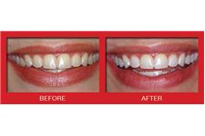 Cosmetic Dentistry Center of NYC image 2
