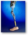 Apex Orthotics & Prosthetics image 3