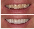 Joseph Mazzola Dentistry image 10