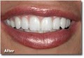 Long Beach Dentist image 7