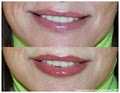 Permanent Makeup Site Los Gatos, CA image 3