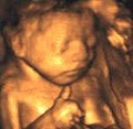 4D Fetal Imaging - 3D/4D Ultrasound In San Jose image 3