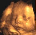 4D Fetal Imaging - 3D/4D Ultrasound In San Jose image 7