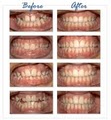 AA Orthodontics for children and adults image 2