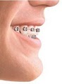 AA Orthodontics for children and adults logo