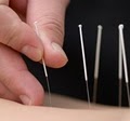 Acupuncture Works image 6