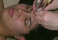Body Mind Spirit Acupuncture, Facial Rejuvenation Skin Care image 8