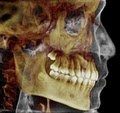 Burien Oral and Maxillofacial Imaging image 2