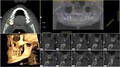 Burien Oral and Maxillofacial Imaging image 3