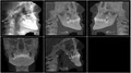 Burien Oral and Maxillofacial Imaging image 4